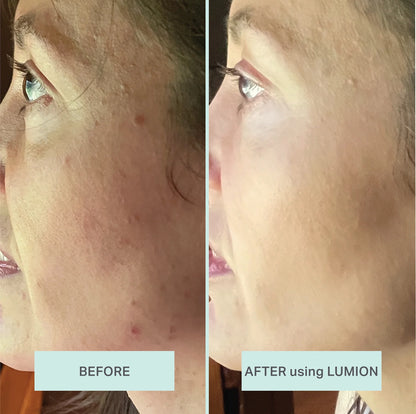 Save My Skin Serum